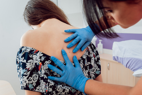 dermatologist examining a patient's skin
