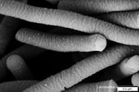 New Study Indicates Link Between Gut Bacteria and Depression
